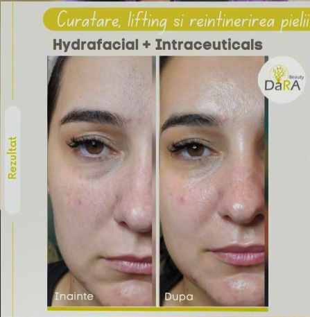 oferta